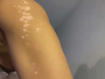 Bongacams Sex Chat of dalmatian-girl