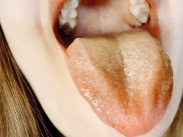Bongacams Best live sex cam show of hotmiamix