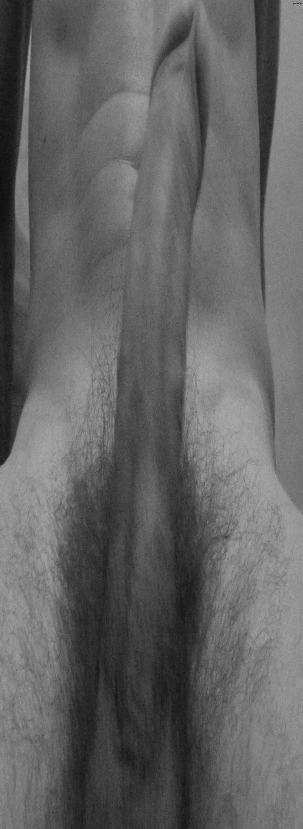 tupedazo2