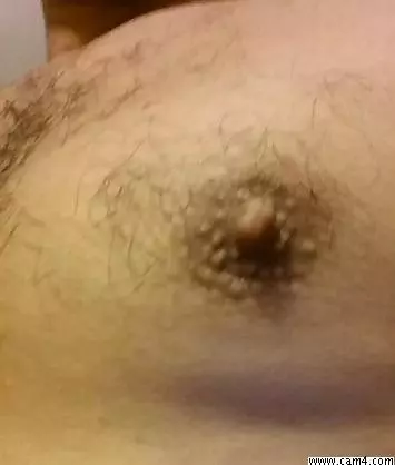 chupametetas