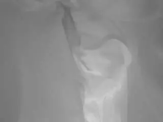 Camsoda Sex Cam of voyeurcam-baileybase-shower