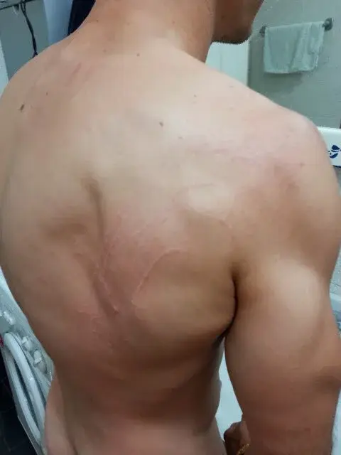 infilaperseicolrestodidue