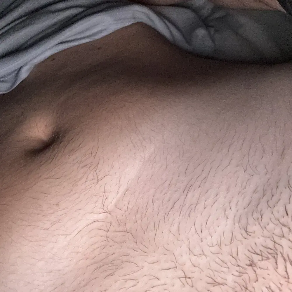 PR_991