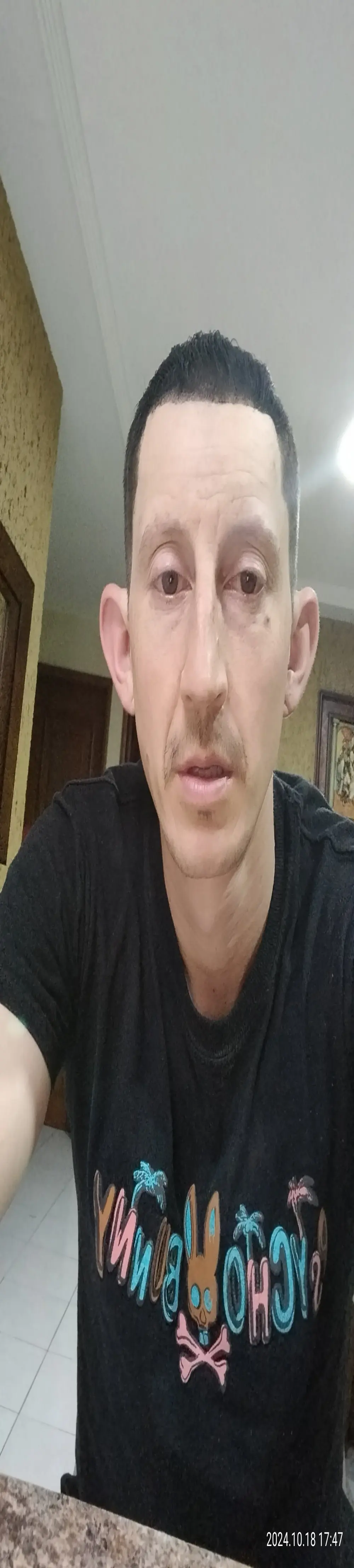 pitudoricoxxx
