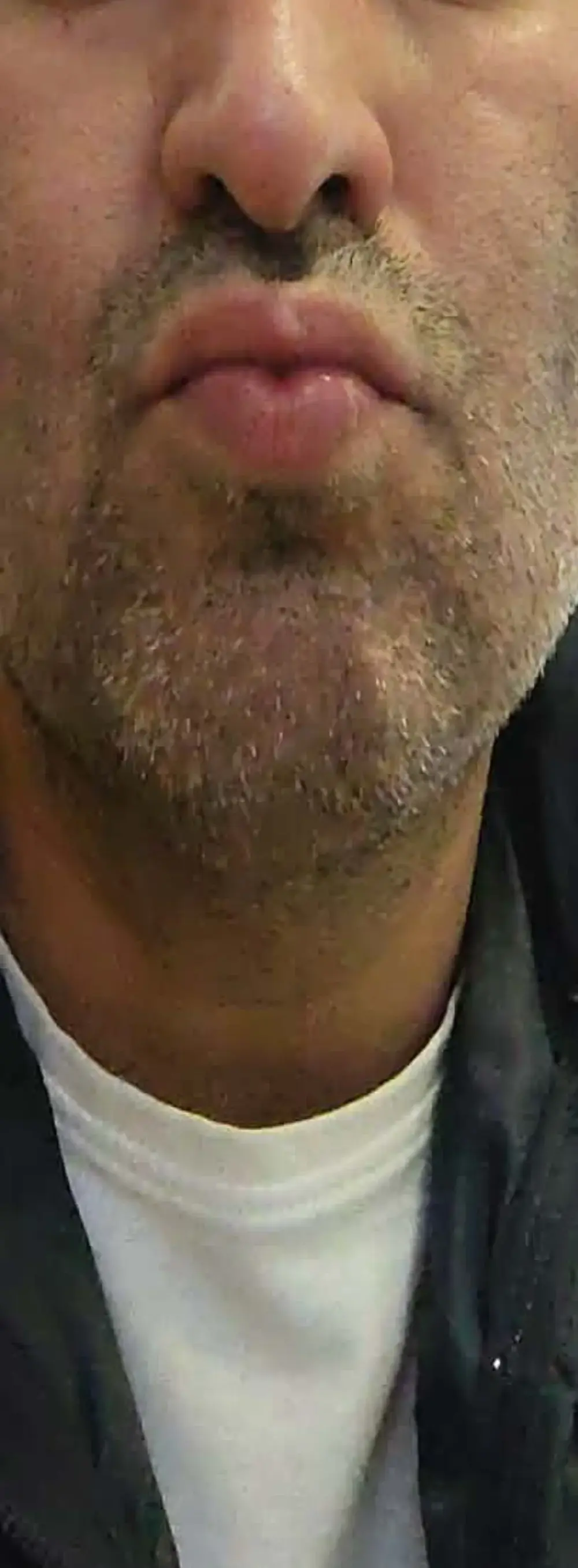 Jekitojj