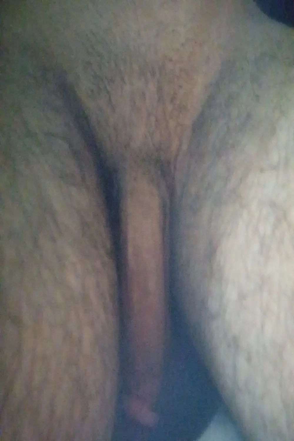 manisa_sikici45