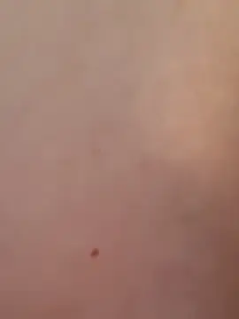 Stripchat Best Webcam of MiaBlossom