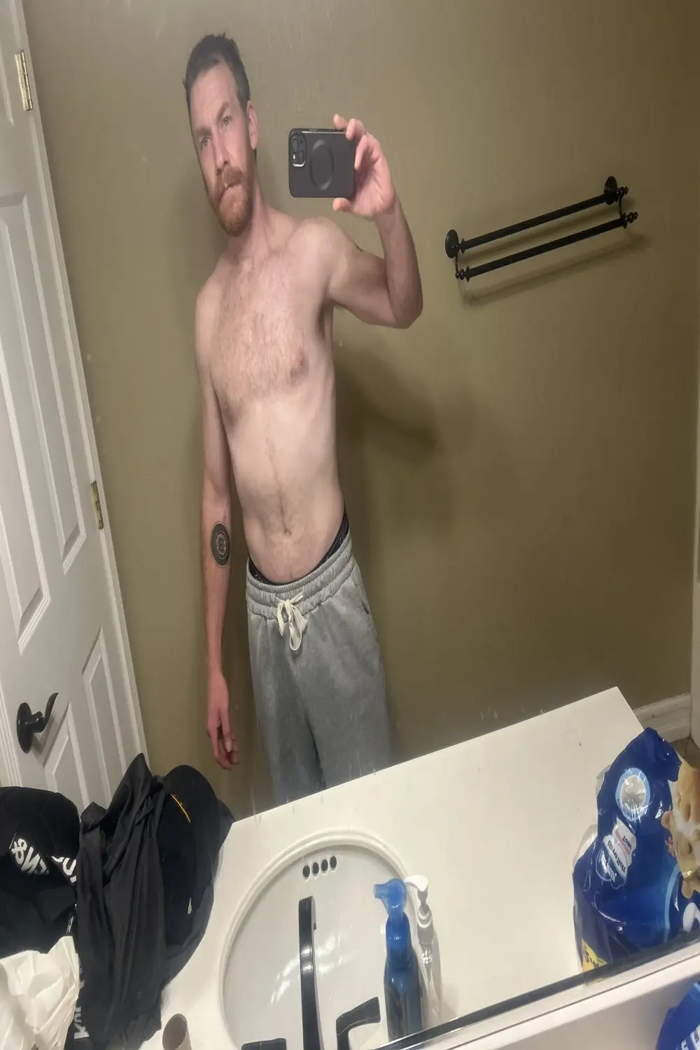Tiggitytomociti